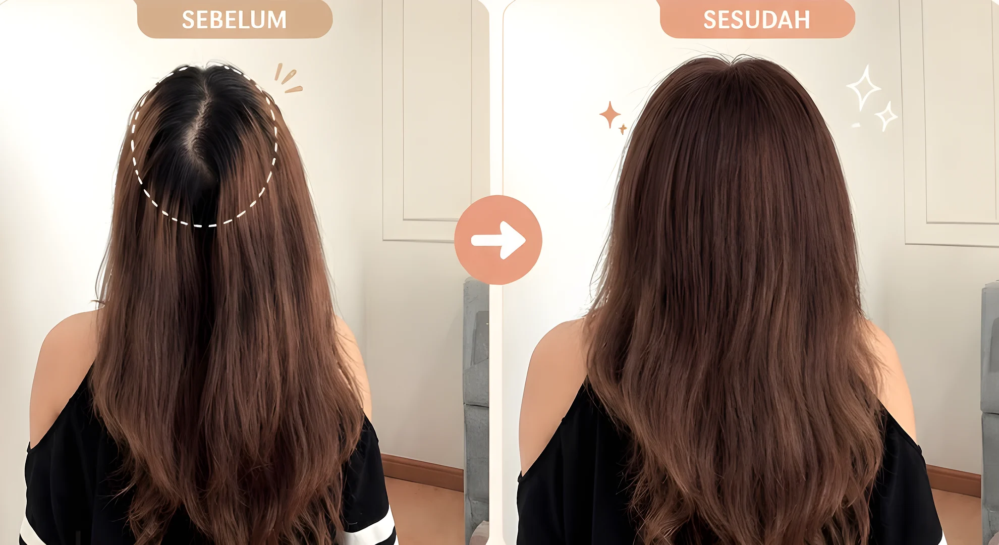 Sebelum dan sesudah memakai hair topper BYLIAN: area rambut tipis di bagian atas tertutup dan rambut tampak lebih penuh